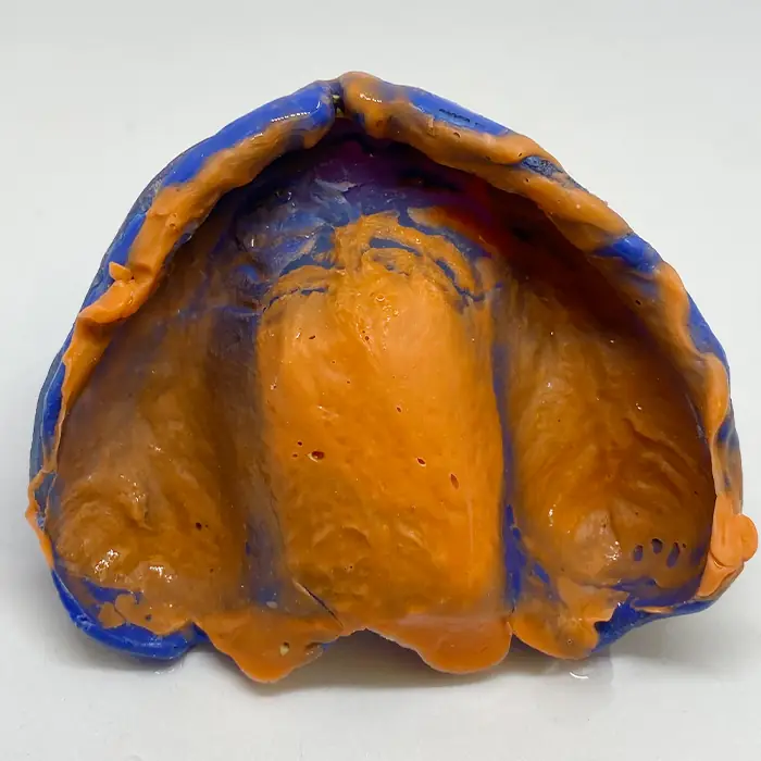 Denture reline impression