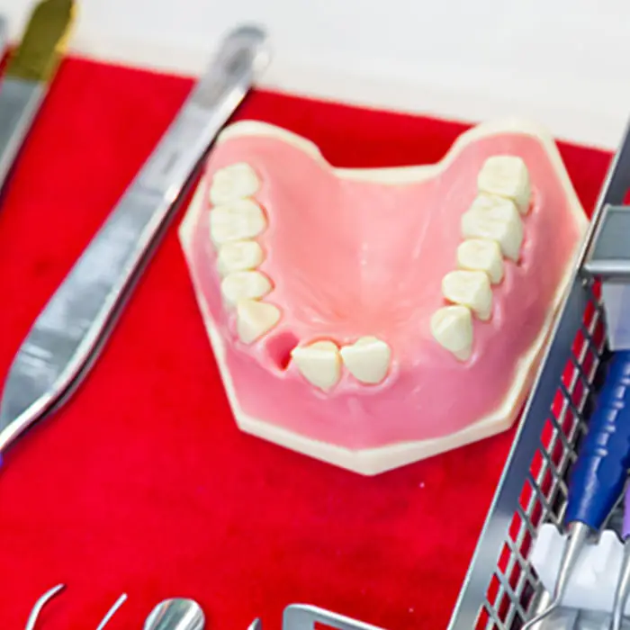 Denture being repaired in the lab